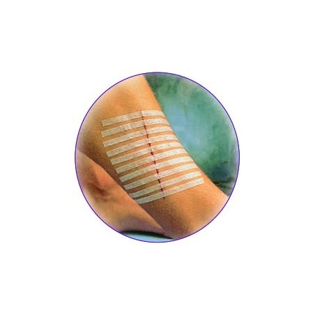 Sutures cutanées adhésives stériles 3M™ Steri-Strip™*