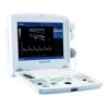 Echographe fœtal portable DUS 60