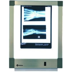 Négatoscope standard