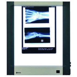 Négatoscope extra-plat