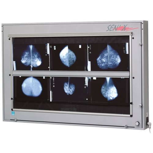 Négatoscope de mammographie Sen’X 12